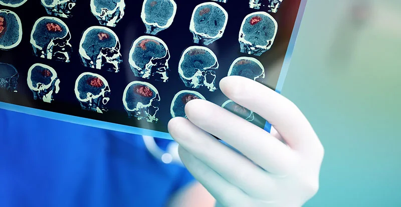 Medical X-ray imaging equipment bearing