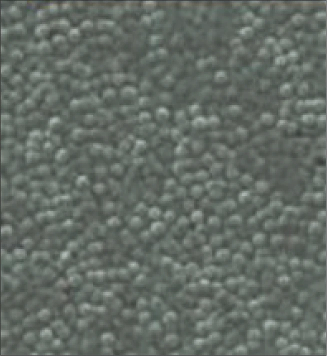 DURALLOY® 塗層結構顯微圖